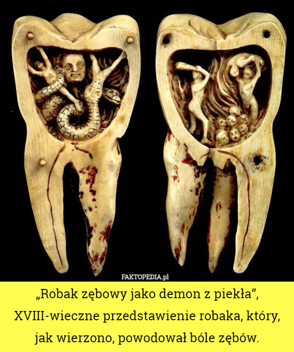 „Robak zębowy jako demon z piekła”, XVIII-wieczne przedstawienie robaka, który, jak wierzono, powodował bóle zębów. 