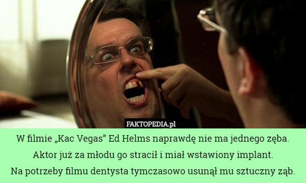 W filmie „Kac Vegas” Ed Helms naprawdę nie ma jednego zęba. Aktor już za młodu go stracił i miał wstawiony implant.
 Na potrzeby filmu dentysta tymczasowo usunął mu sztuczny ząb. 