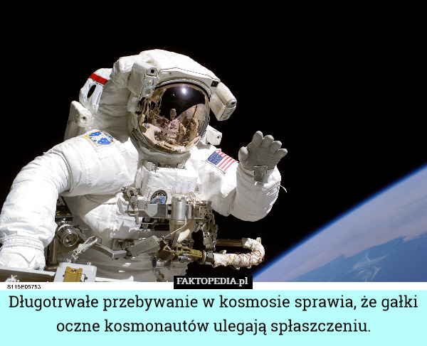 Długotrwałe przebywanie w kosmosie sprawia, że gałki oczne kosmonautów ulegają spłaszczeniu. 