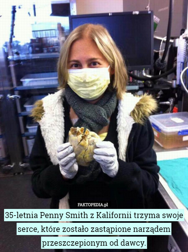 35-letnia Penny Smith z Kalifornii trzyma swoje serce, które zostało zastąpione narządem przeszczepionym od dawcy. 