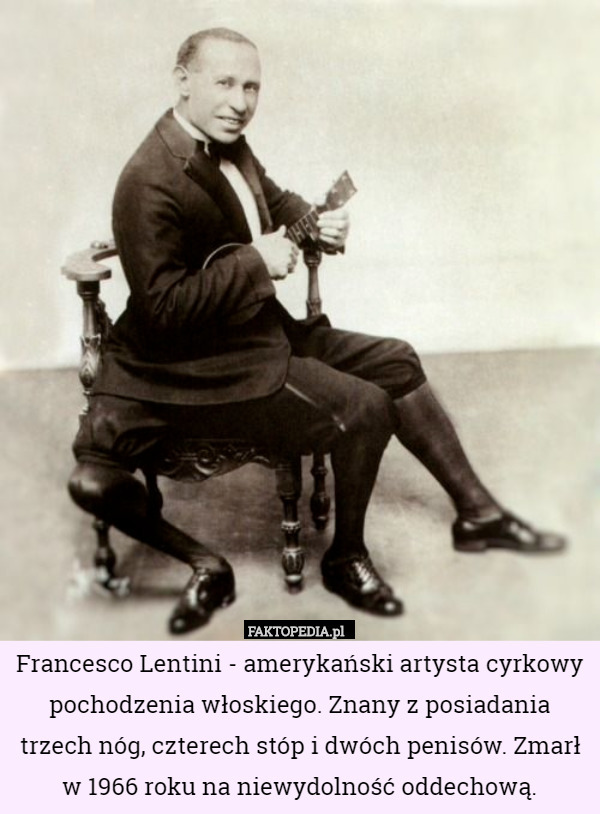 Francesco Lentini - amerykański artysta cyrkowy pochodzenia włoskiego. Znany z posiadania trzech nóg, czterech stóp i dwóch penisów. Zmarł w 1966 roku na niewydolność oddechową. 