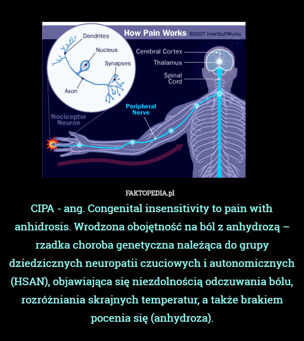 CIPA - ang. Congenital insensitivity to pain with anhidrosis. Wrodzona obojętność na ból z anhydrozą – rzadka choroba genetyczna należąca do grupy dziedzicznych neuropatii czuciowych i autonomicznych (HSAN), objawiająca się niezdolnością odczuwania bólu, rozróżniania skrajnych temperatur, a także brakiem pocenia się (anhydroza). 