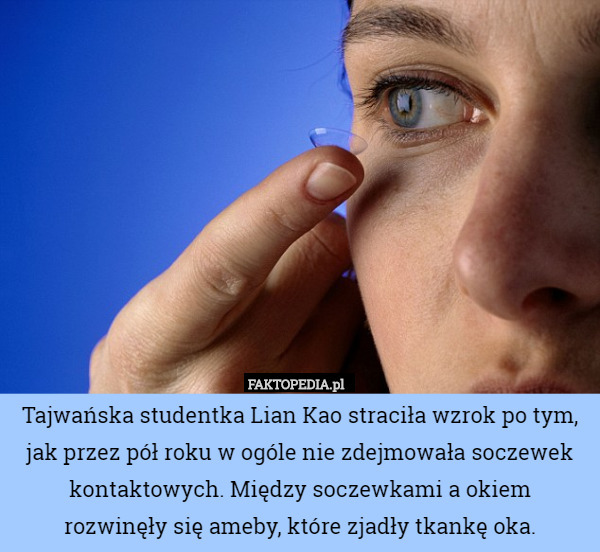 Tajwańska studentka Lian Kao straciła wzrok po tym, jak przez pół roku w ogóle nie zdejmowała soczewek kontaktowych. Między soczewkami a okiem
 rozwinęły się ameby, które zjadły tkankę oka. 