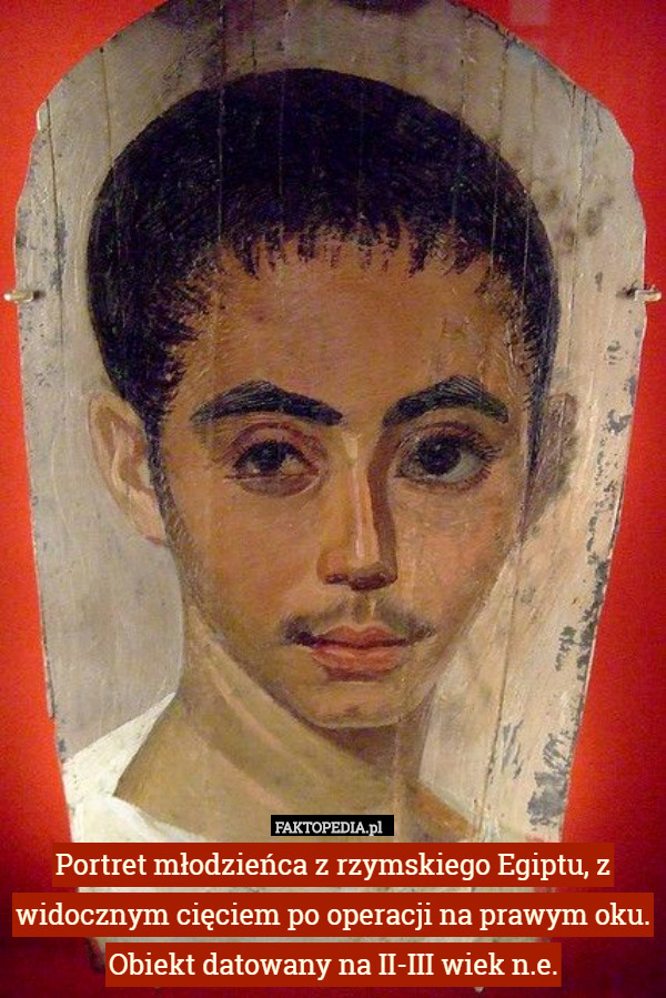 Portret młodzieńca z rzymskiego Egiptu, z widocznym cięciem po operacji na prawym oku. Obiekt datowany na II-III wiek n.e. 