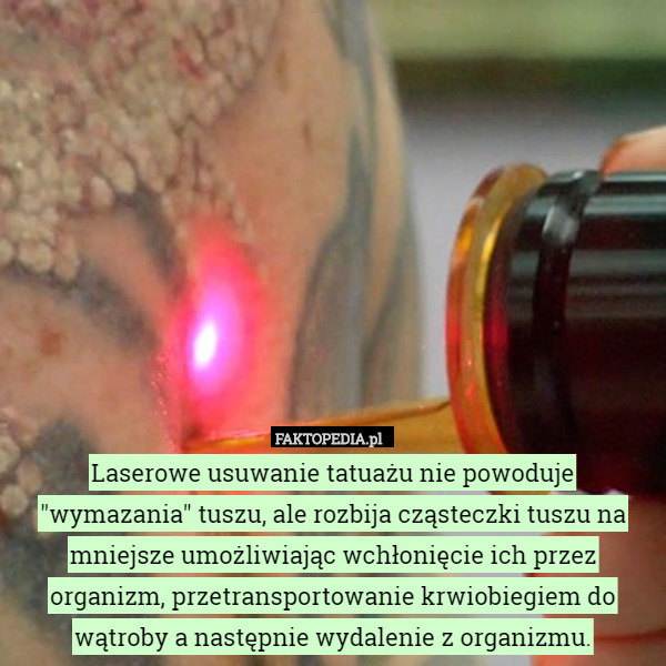 Laserowe usuwanie tatuażu nie powoduje "wymazania" tuszu, ale rozbija cząsteczki tuszu na mniejsze umożliwiając wchłonięcie ich przez organizm, przetransportowanie krwiobiegiem do wątroby a następnie wydalenie z organizmu. 