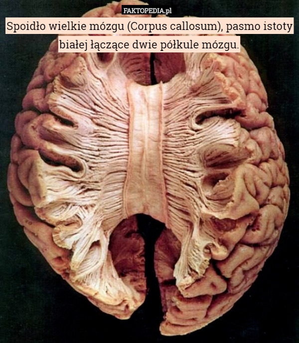 Spoidło wielkie mózgu (Corpus callosum), pasmo istoty białej łączące dwie półkule mózgu. 