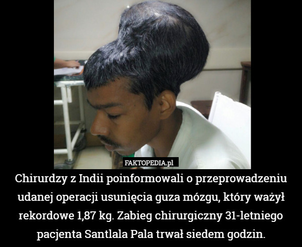 Chirurdzy z Indii poinformowali o przeprowadzeniu udanej operacji usunięcia guza mózgu, który ważył rekordowe 1,87 kg. Zabieg chirurgiczny 31-letniego pacjenta Santlala Pala trwał siedem godzin. 