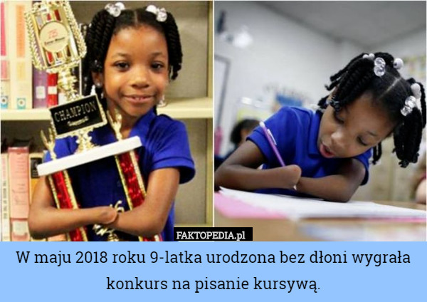 W maju 2018 roku 9-latka urodzona bez dłoni wygrała konkurs na pisanie kursywą. 