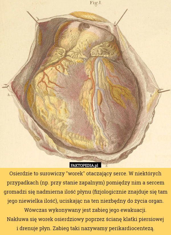 Osierdzie to surowiczy "worek" otaczający serce. W niektórych przypadkach (np. przy stanie zapalnym) pomiędzy nim a sercem gromadzi się nadmierna ilość płynu (fizjologicznie znajduje się tam jego niewielka ilość), uciskając na ten niezbędny do życia organ. Wówczas wykonywany jest zabieg jego ewakuacji.
 Nakłuwa się worek osierdziowy poprzez ścianę klatki piersiowej
 i drenuje płyn. Zabieg taki nazywamy perikardiocentezą. 