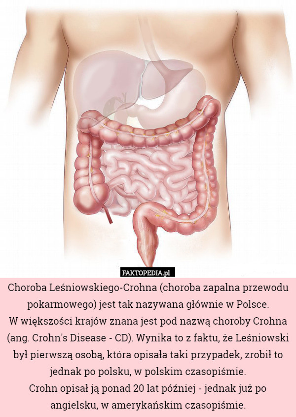 Choroba Leśniowskiego-Crohna (choroba zapalna przewodu pokarmowego) jest tak nazywana głównie w Polsce.
 W większości krajów znana jest pod nazwą choroby Crohna (ang. Crohn's Disease - CD). Wynika to z faktu, że Leśniowski był pierwszą osobą, która opisała taki przypadek, zrobił to jednak po polsku, w polskim czasopiśmie.
 Crohn opisał ją ponad 20 lat później - jednak już po angielsku, w amerykańskim czasopiśmie. 