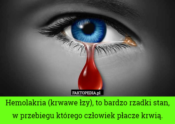 Hemolakria (krwawe łzy), to bardzo rzadki stan, w przebiegu którego człowiek płacze krwią. 