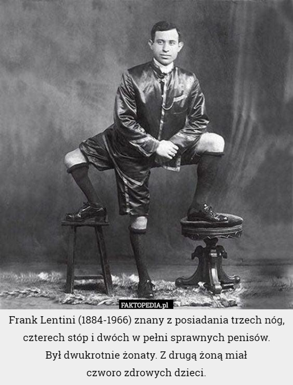 Frank Lentini (1884-1966) znany z posiadania trzech nóg, czterech stóp i dwóch w pełni sprawnych penisów.
Był dwukrotnie żonaty. Z drugą żoną miał
 czworo zdrowych dzieci. 