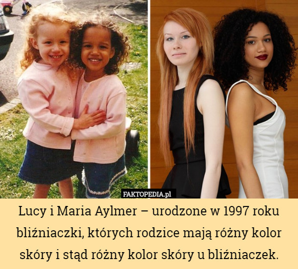 Lucy i Maria Aylmer – urodzone w 1997 roku bliźniaczki, których rodzice mają różny kolor skóry i stąd różny kolor skóry u bliźniaczek. 