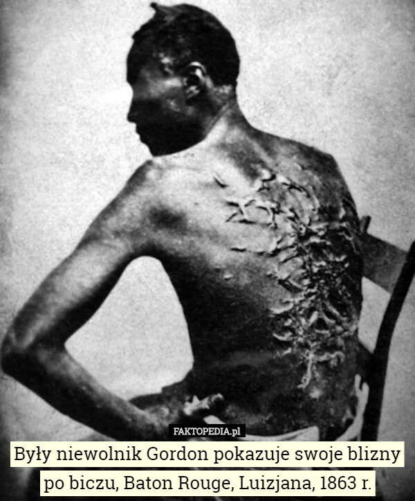 Były niewolnik Gordon pokazuje swoje blizny po biczu, Baton Rouge, Luizjana, 1863 r. 
