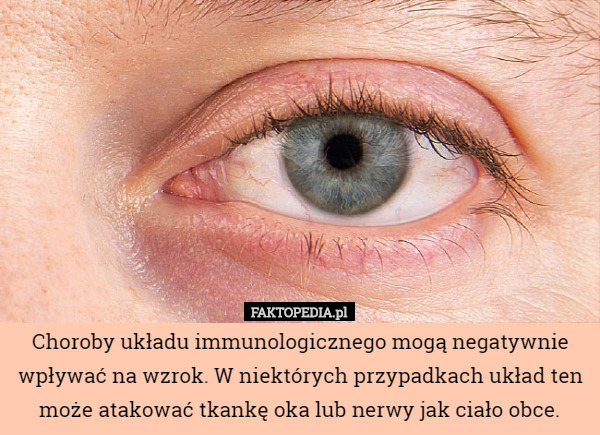 Choroby układu immunologicznego mogą negatywnie wpływać na wzrok. W niektórych przypadkach układ ten może atakować tkankę oka lub nerwy jak ciało obce. 