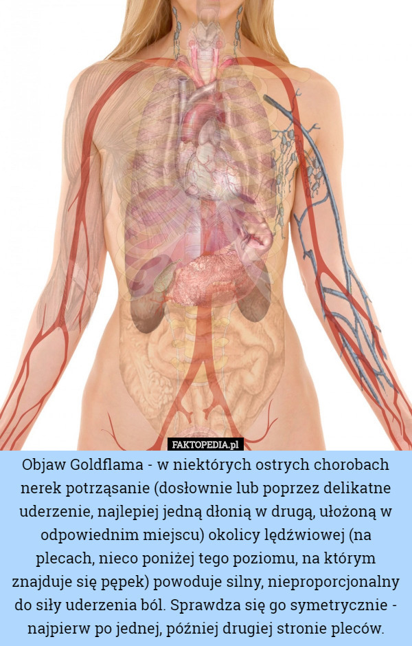 Objaw Goldflama - w niektórych ostrych chorobach nerek potrząsanie (dosłownie lub poprzez delikatne uderzenie, najlepiej jedną dłonią w drugą, ułożoną w odpowiednim miejscu) okolicy lędźwiowej (na plecach, nieco poniżej tego poziomu, na którym znajduje się pępek) powoduje silny, nieproporcjonalny do siły uderzenia ból. Sprawdza się go symetrycznie - najpierw po jednej, później drugiej stronie pleców. 