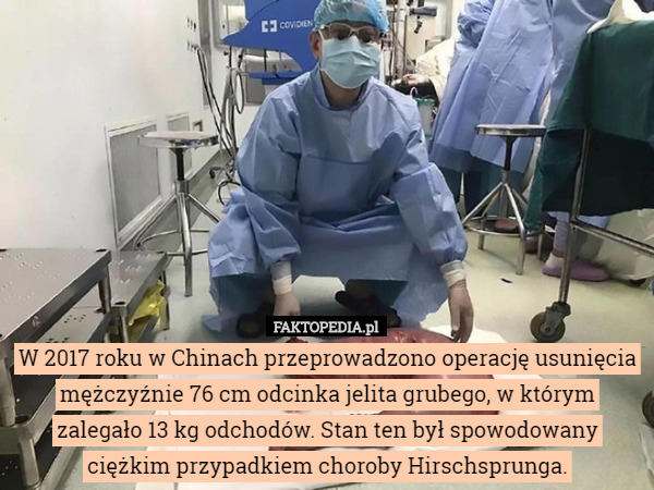 W 2017 roku w Chinach przeprowadzono operację usunięcia mężczyźnie 76 cm odcinka jelita grubego, w którym zalegało 13 kg odchodów. Stan ten był spowodowany ciężkim przypadkiem choroby Hirschsprunga. 