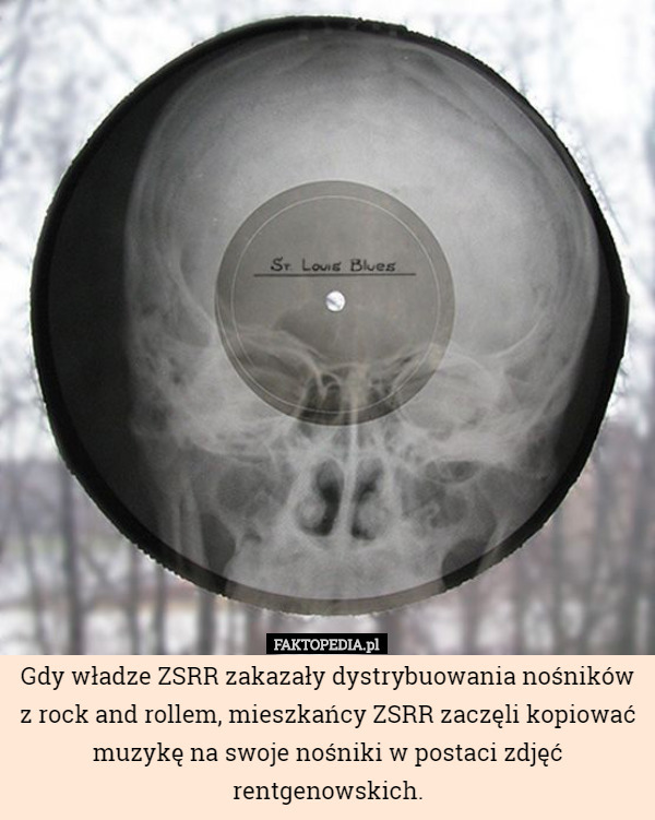 Gdy władze ZSRR zakazały dystrybuowania nośników z rock and rollem, mieszkańcy ZSRR zaczęli kopiować muzykę na swoje nośniki w postaci zdjęć rentgenowskich. 
