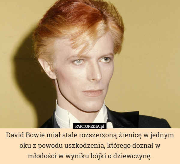 David Bowie miał stale rozszerzoną źrenicę w jednym oku z powodu uszkodzenia, którego doznał w
 młodości w wyniku bójki o dziewczynę. 
