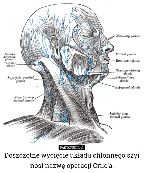 Doszczętne wycięcie układu chłonnego szyi nosi nazwę operacji Crile'a. 