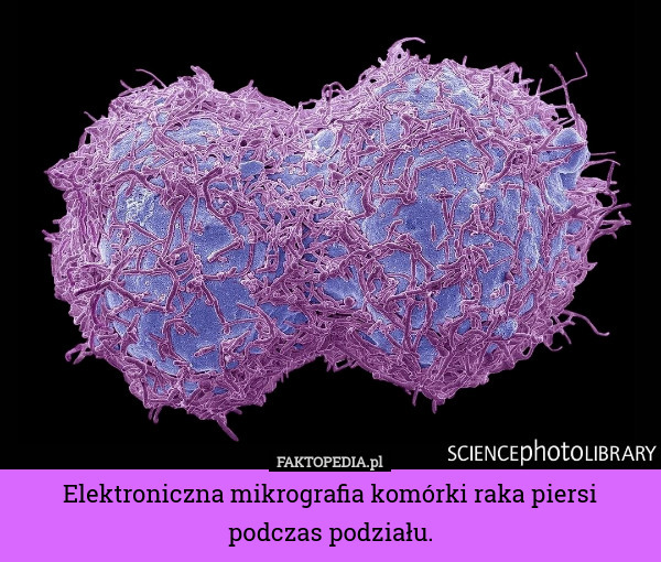 Elektroniczna mikrografia komórki raka piersi podczas podziału. 