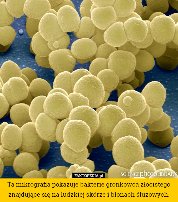 Ta mikrografia pokazuje bakterie gronkowca złocistego znajdujące się na ludzkiej skórze i błonach śluzowych. 