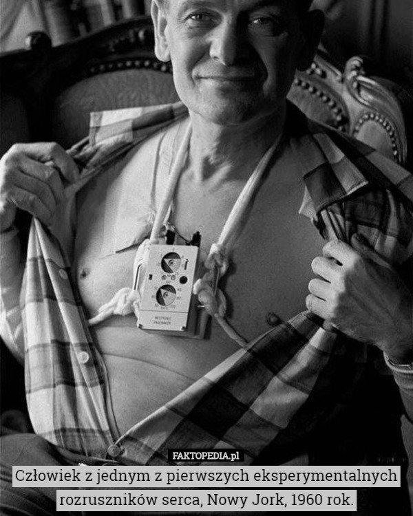 Człowiek z jednym z pierwszych eksperymentalnych rozruszników serca, Nowy Jork, 1960 rok. 