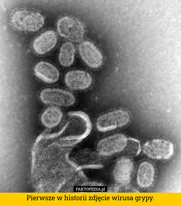 Pierwsze w historii zdjęcie wirusa grypy. 