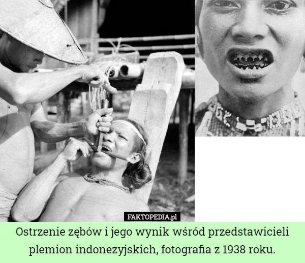 Ostrzenie zębów i jego wynik wśród przedstawicieli plemion indonezyjskich, fotografia z 1938 roku. 