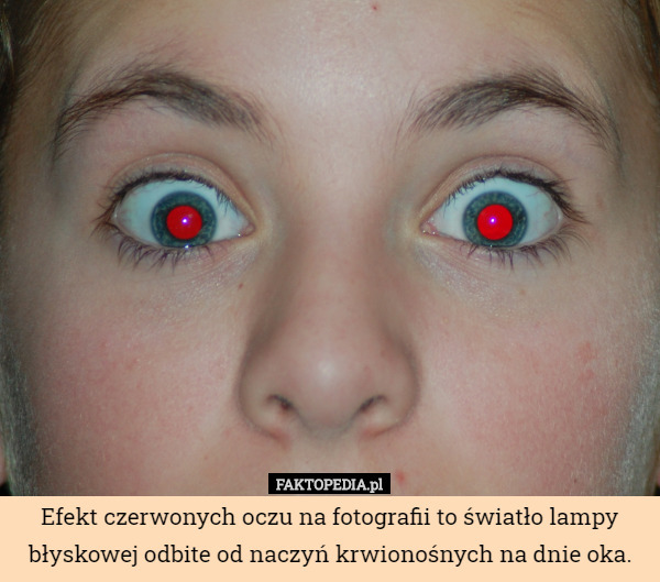 Efekt czerwonych oczu na fotografii to światło lampy błyskowej odbite od naczyń krwionośnych na dnie oka. 