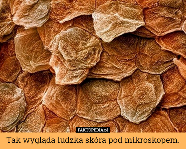 Tak wygląda ludzka skóra pod mikroskopem. 