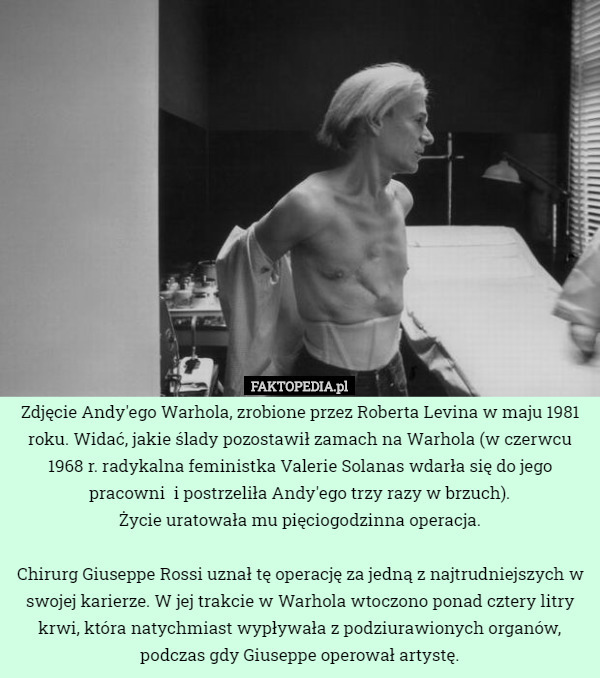 Zdjęcie Andy'ego Warhola, zrobione przez Roberta Levina w maju 1981 roku. Widać, jakie ślady pozostawił zamach na Warhola (w czerwcu 1968 r. radykalna feministka Valerie Solanas wdarła się do jego pracowni  i postrzeliła Andy'ego trzy razy w brzuch).
 Życie uratowała mu pięciogodzinna operacja.

 Chirurg Giuseppe Rossi uznał tę operację za jedną z najtrudniejszych w swojej karierze. W jej trakcie w Warhola wtoczono ponad cztery litry krwi, która natychmiast wypływała z podziurawionych organów, podczas gdy Giuseppe operował artystę. 