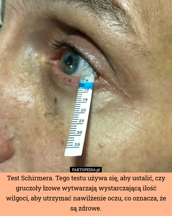 Test Schirmera. Tego testu używa się, aby ustalić, czy gruczoły łzowe wytwarzają wystarczającą ilość wilgoci, aby utrzymać nawilżenie oczu, co oznacza, że ​​są zdrowe. 