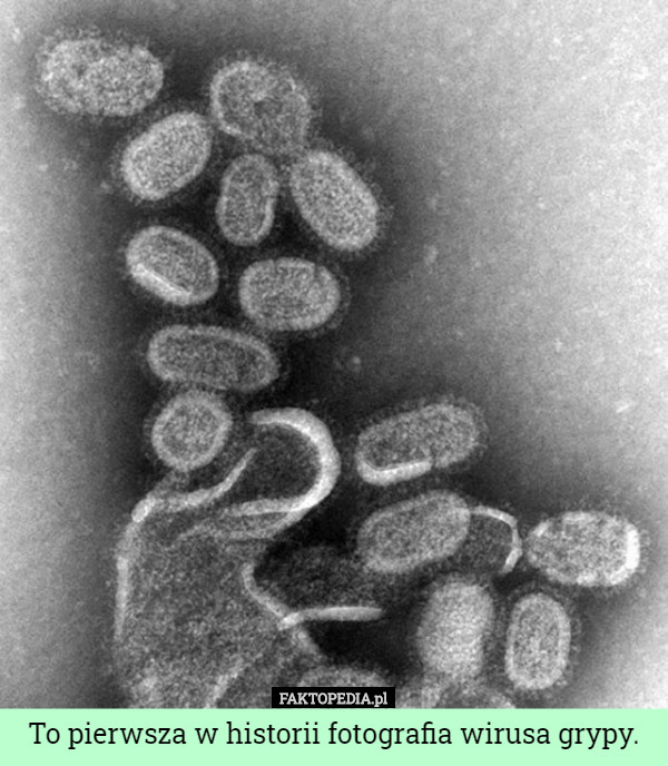 To pierwsza w historii fotografia wirusa grypy. 