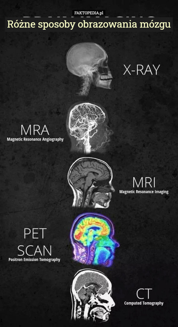 Różne sposoby obrazowania mózgu 