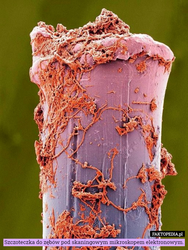 Szczoteczka do zębów pod skaningowym mikroskopem elektronowym. 