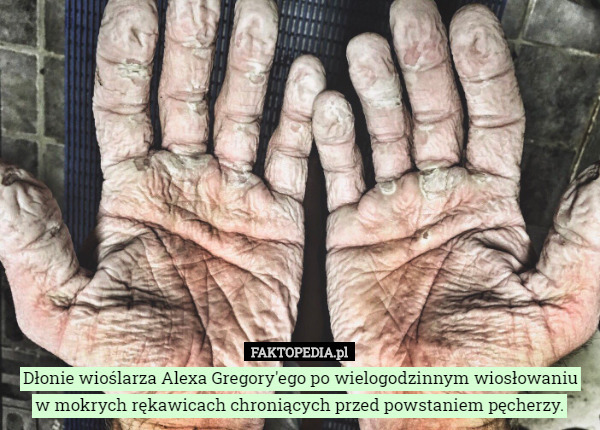 Dłonie wioślarza Alexa Gregory'ego po wielogodzinnym wiosłowaniu w mokrych rękawicach chroniących przed powstaniem pęcherzy. 