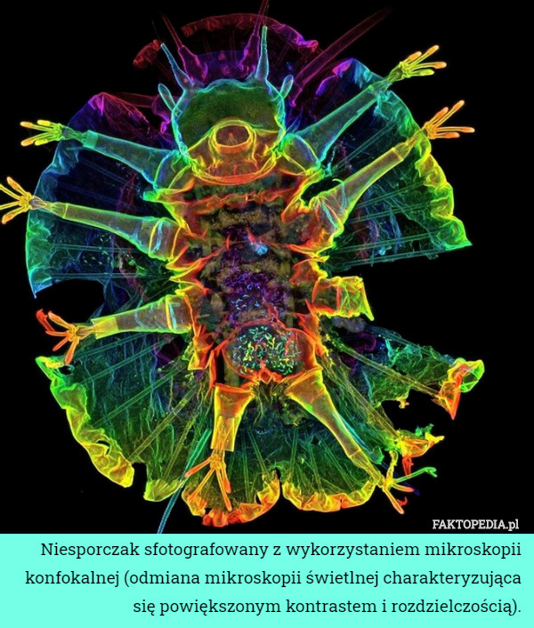 Niesporczak sfotografowany z wykorzystaniem mikroskopii konfokalnej (odmiana mikroskopii świetlnej charakteryzująca się powiększonym kontrastem i rozdzielczością). 