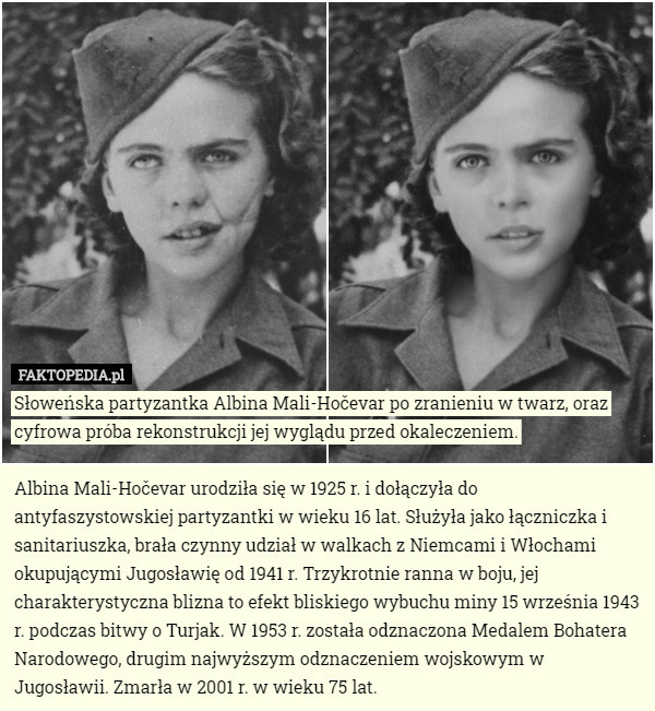 Słoweńska partyzantka Albina Mali-Hočevar po zranieniu w twarz, oraz cyfrowa próba rekonstrukcji jej wyglądu przed okaleczeniem.

Albina Mali-Hočevar urodziła się w 1925 r. i dołączyła do antyfaszystowskiej partyzantki w wieku 16 lat. Służyła jako łączniczka i sanitariuszka, brała czynny udział w walkach z Niemcami i Włochami okupującymi Jugosławię od 1941 r. Trzykrotnie ranna w boju, jej charakterystyczna blizna to efekt bliskiego wybuchu miny 15 września 1943 r. podczas bitwy o Turjak. W 1953 r. została odznaczona Medalem Bohatera Narodowego, drugim najwyższym odznaczeniem wojskowym w Jugosławii. Zmarła w 2001 r. w wieku 75 lat. 
