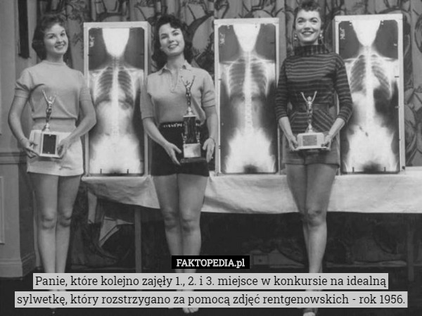 Panie, które kolejno zajęły 1., 2. i 3. miejsce w konkursie na idealną sylwetkę, który rozstrzygano za pomocą zdjęć rentgenowskich - rok 1956. 