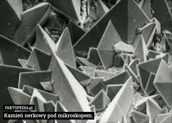 Kamień nerkowy pod mikroskopem. 