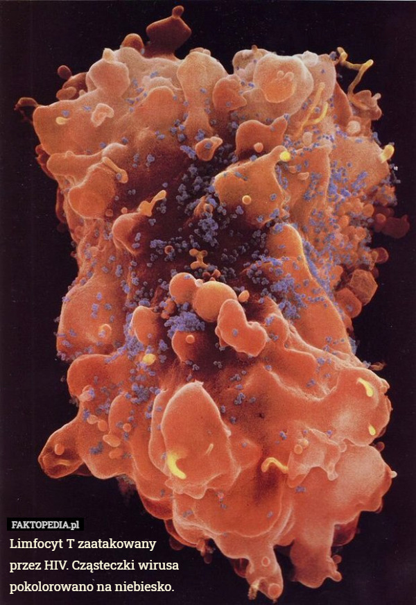 Limfocyt T zaatakowany przez HIV. Cząsteczki wirusa pokolorowano na niebiesko. 