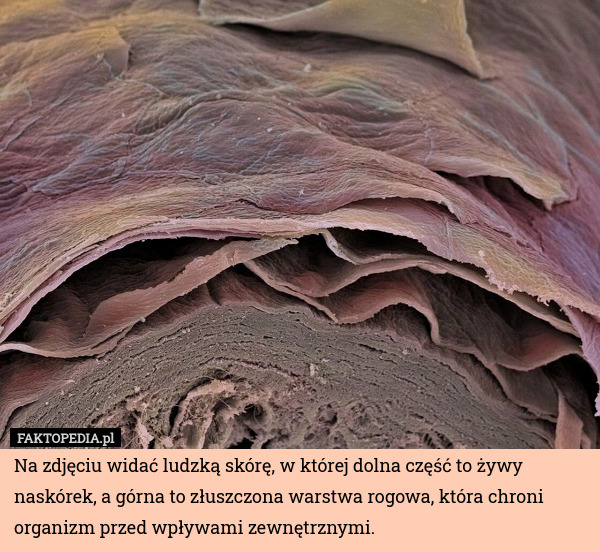 Na zdjęciu widać ludzką skórę, w której dolna część to żywy naskórek, a górna to złuszczona warstwa rogowa, która chroni organizm przed wpływami zewnętrznymi. 