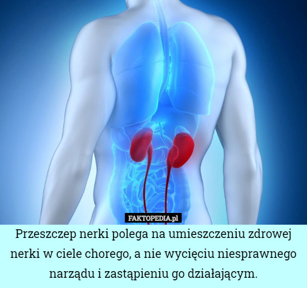 Przeszczep nerki polega na umieszczeniu zdrowej nerki w ciele chorego, a nie wycięciu niesprawnego narządu i zastąpieniu go działającym. 