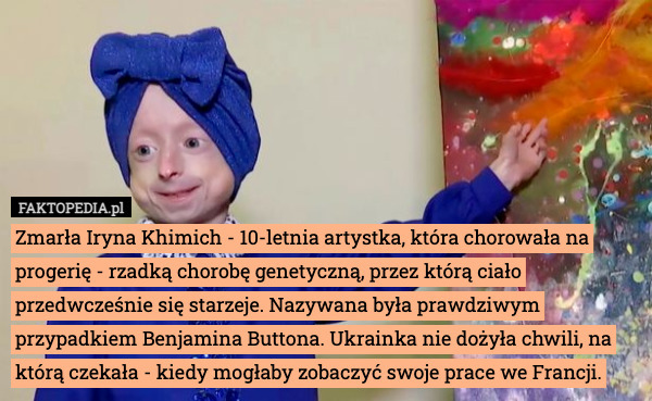 Zmarła Iryna Khimich - 10-letnia artystka, która chorowała na progerię - rzadką chorobę genetyczną, przez którą ciało przedwcześnie się starzeje. Nazywana była prawdziwym przypadkiem Benjamina Buttona. Ukrainka nie dożyła chwili, na którą czekała - kiedy mogłaby zobaczyć swoje prace we Francji. 