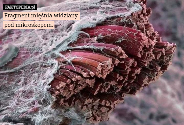 Fragment mięśnia widziany 
pod mikroskopem. 