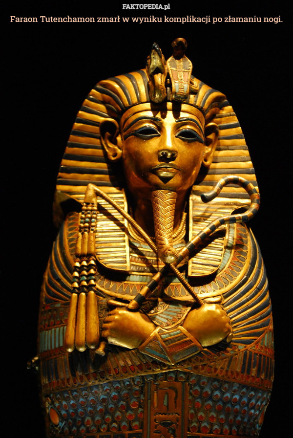 Faraon Tutenchamon zmarł w wyniku komplikacji po złamaniu nogi. 