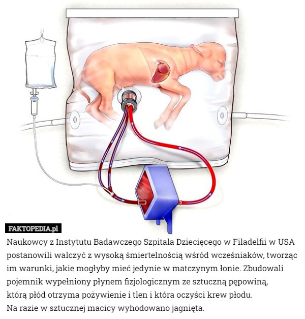 Naukowcy z Instytutu Badawczego Szpitala Dziecięcego w Filadelfii w USA postanowili walczyć z wysoką śmiertelnością wśród wcześniaków, tworząc im warunki, jakie mogłyby mieć jedynie w matczynym łonie. Zbudowali pojemnik wypełniony płynem fizjologicznym ze sztuczną pępowiną,
 którą płód otrzyma pożywienie i tlen i która oczyści krew płodu.
 Na razie w sztucznej macicy wyhodowano jagnięta. 