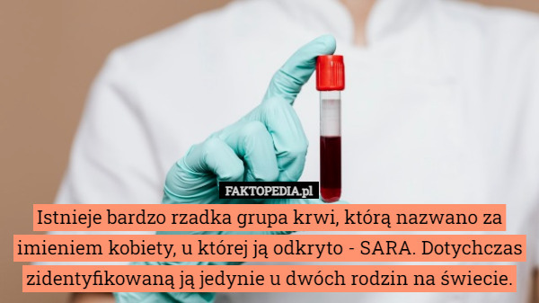 Istnieje bardzo rzadka grupa krwi, którą nazwano za imieniem kobiety, u której ją odkryto - SARA. Dotychczas zidentyfikowaną ją jedynie u dwóch rodzin na świecie. 
