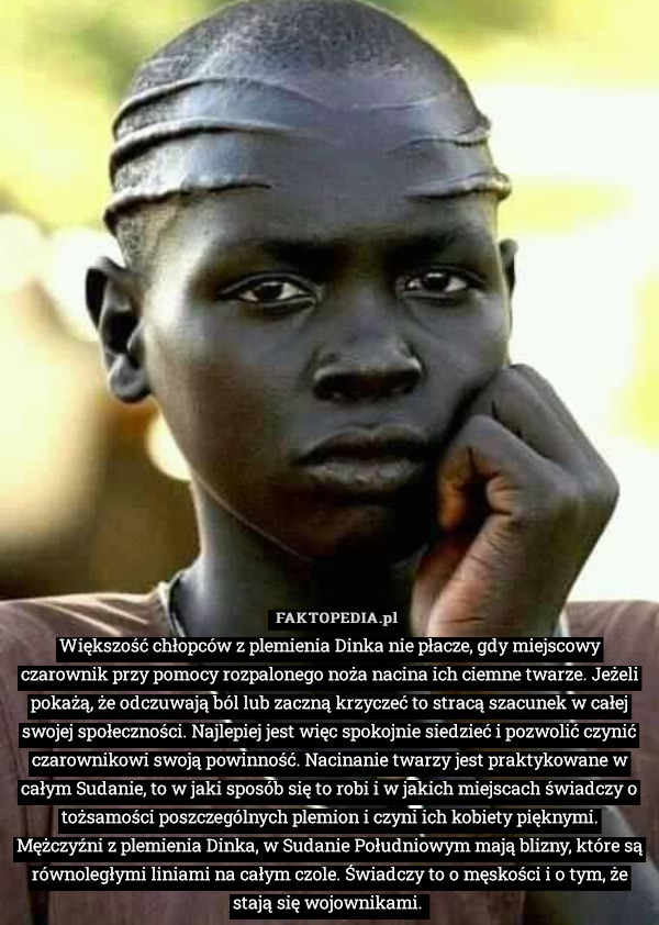 Większość chłopców z plemienia Dinka nie płacze, gdy miejscowy czarownik przy pomocy rozpalonego noża nacina ich ciemne twarze. Jeżeli pokażą, że odczuwają ból lub zaczną krzyczeć to stracą szacunek w całej swojej społeczności. Najlepiej jest więc spokojnie siedzieć i pozwolić czynić czarownikowi swoją powinność. Nacinanie twarzy jest praktykowane w całym Sudanie, to w jaki sposób się to robi i w jakich miejscach świadczy o tożsamości poszczególnych plemion i czyni ich kobiety pięknymi.
Mężczyźni z plemienia Dinka, w Sudanie Południowym mają blizny, które są równoległymi liniami na całym czole. Świadczy to o męskości i o tym, że stają się wojownikami. 